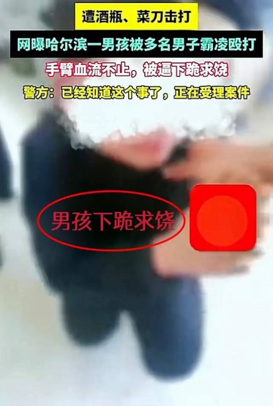 2024年2月五常男孩遭多人围殴并被砍伤事件