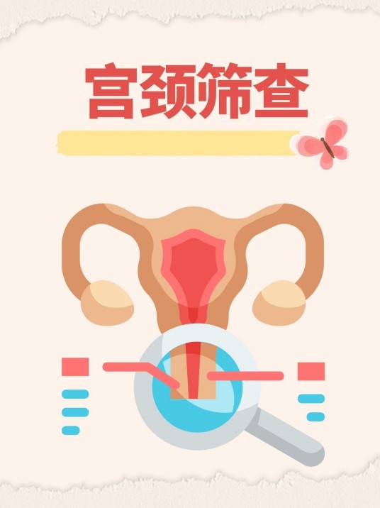 宫颈癌筛查