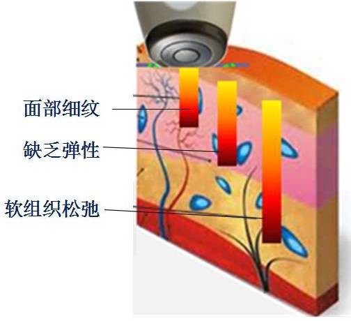 热拉提