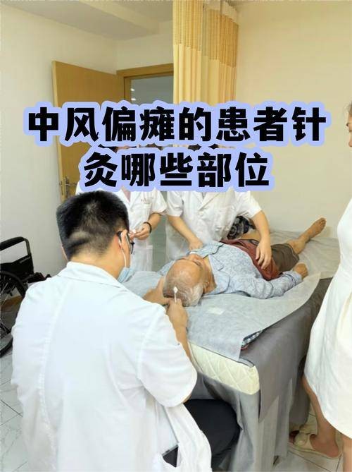 针灸治疗中风
