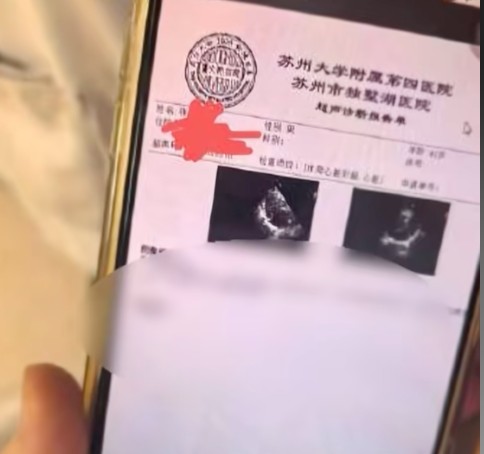 3·24张雪峰医疗文件泄露事件
